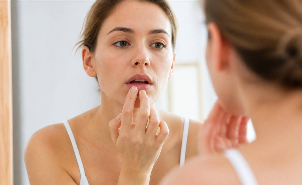 Chapped lips : causes, remèdes naturels et conseils pour les lèvres gercées