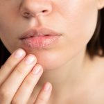 Gercure des levres : causes, soins naturels et conseils pour des lèvres réparées